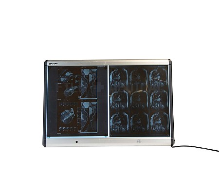 Double Wall Mount Light Box X- Rays priced Separately 